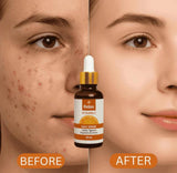 RELAX | FACE SERUM 30ML (VITAMIN C)
